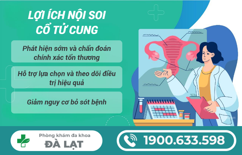 Hình ảnh minh họa